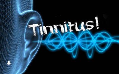 Pulsos electromagnéticos utilizados para tratar el tinnitus.